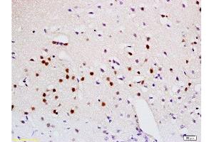 Formalin-fixed and paraffin embedded mouse brain labeled with Anti-Sema3A Polyclonal Antibody, Unconjugated  at 1:200 followed by conjugation to the secondary antibody and DAB staining.