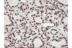 Image no. 1 for anti-F-Box Protein 21 (FBXO21) antibody (ABIN1498233) (FBXO21 Antikörper)