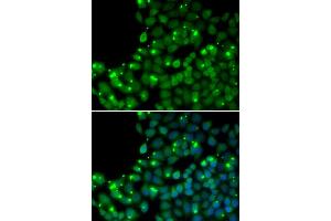 Immunofluorescence analysis of U2OS cells using MGMT antibody (ABIN5970267). (MGMT Antikörper)