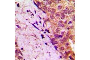 Immunohistochemistry (IHC) image for anti-Amyloid beta (A4) Precursor Protein-Binding, Family B, Member 2 (APBB2) antibody (ABIN7303188)