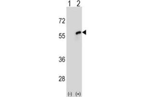 Western Blotting (WB) image for anti-Cell Division Cycle 20 Homolog (S. Cerevisiae) (CDC20) antibody (ABIN3004047)