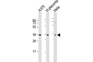 All lanes : Anti-FGF5 Antibody (N-Term) at 1:2000 dilution Lane 1:  whole cell lysate Lane 2: human placenta lysate Lane 3: Hela whole cell lysate Lysates/proteins at 20 μg per lane. (FGF5 Antikörper  (AA 140-172))