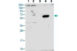 Western blot analysis of Lane 1: RT-4, Lane 2: U-251 MG, Lane 3: Human Plasma, Lane 4: Liver, Lane 5: Tonsil with ZNF837 polyclonal antibody  at 1:250-1:500 dilution. (ZNF837 Antikörper)