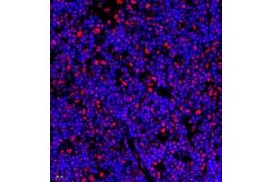 Immunofluorescence of paraffin embedded rat thymus using Skar (ABIN7074970) at dilution of 1:950 (400x lens) (p46 Antikörper)
