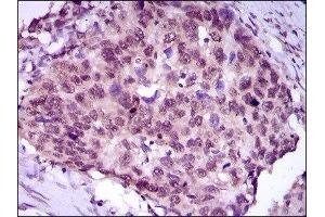 Immunohistochemistry (IHC) image for anti-Myocyte Enhancer Factor 2C (MEF2C) (AA 1-125) antibody (ABIN1846463)