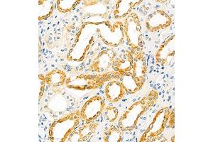 Immunohistochemistry of paraffin embedded human kidney using SLC22A12 (ABIN7075662) at dilution of 1:2100 (300x lens) (SLC22A12 Antikörper)