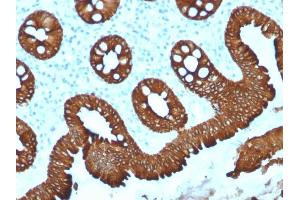 Immunohistochemistry (IHC) image for anti-Keratin 20 (KRT20) (AA 196-323) antibody (ABIN6940347)