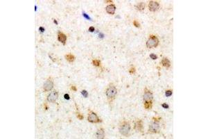 Immunohistochemical analysis of GPR126 staining in human brain formalin fixed paraffin embedded tissue section. (G Protein-Coupled Receptor 126 Antikörper)