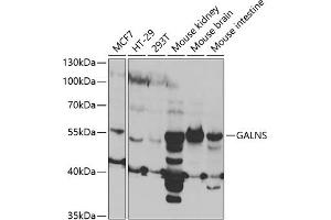 Western blot analysis of extracts of various cell lines, using GALNS antibody (ABIN6131691, ABIN6140937, ABIN6140938 and ABIN6221120) at 1:1000 dilution. (GALNS Antikörper  (AA 353-522))