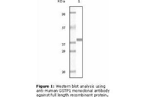 Image no. 2 for anti-Glutathione S-Transferase pi 1 (GSTP1) antibody (ABIN207627) (GSTP1 Antikörper)