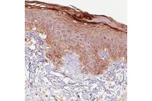 Immunohistochemical staining (Formalin-fixed paraffin-embedded sections) of human skin with RNASE7 monoclonal antibody, clone CL0224  shows immunoreactivity in keratinocytes, particularly strong in the outer layer. (RNASE7 Antikörper)