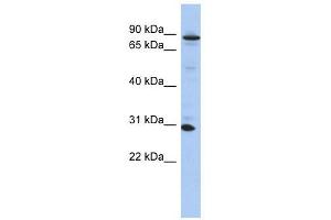 ANKRD47 antibody used at 1 ug/ml to detect target protein. (KANK3 Antikörper  (N-Term))