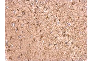 IHC-P Image GPBB antibody detects GPBB protein at cytosol on mouse fore brain by immunohistochemical analysis. (PYGB Antikörper  (C-Term))