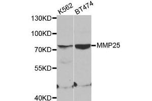 Western blot analysis of extracts of various cell lines, using MMP25 antibody. (MMP25 Antikörper)