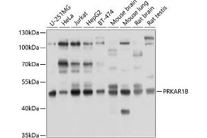 Western blot analysis of extracts of various cell lines, using PRKB antibody (ABIN6130039, ABIN6146193, ABIN6146194 and ABIN6214262) at 1:1000 dilution. (PRKAR1B Antikörper  (AA 190-290))