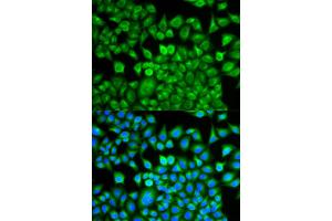 Immunofluorescence analysis of MCF-7 cells using FABP1 antibody (ABIN5973056). (FABP1 Antikörper)