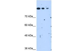 Human HepG2 cells SETD2 is strongly supported by BioGPS gene expression data to be expressed in Human HepG2 cells (SETD2 Antikörper  (N-Term))