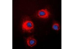 Immunofluorescent analysis of STMN1 (pS16) staining in HeLa cells. (Stathmin 1 Antikörper  (N-Term, pSer16))