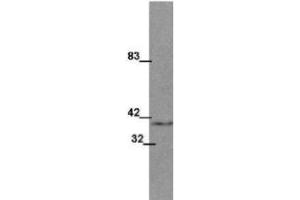 Western Blotting (WB) image for anti-Wingless-Type MMTV Integration Site Family, Member 1 (WNT1) (Internal Region) antibody (ABIN964685)
