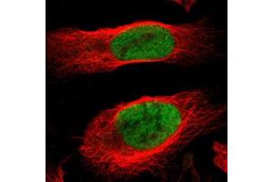 Immunofluorescent staining of U-2 OS with MCM4 polyclonal antibody  (Green) shows positivity in nucleus but excluded from the nucleoli. (MCM4 Antikörper)