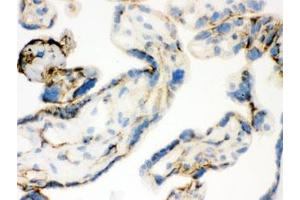 IHC-F: TGM2 antibody testing of human placental tissue (Transglutaminase 2 Antikörper)