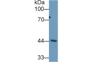 Western Blotting (WB) image for anti-REV1, Polymerase (DNA Directed) (REV1) (AA 301-478) antibody (ABIN7437113)