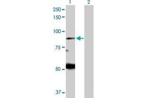 Lane 1: EIF2AK1 transfected lysate ( 71. (EIF2AK1 293T Cell Transient Overexpression Lysate(Denatured))