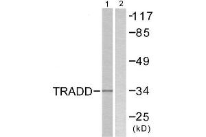 Western Blotting (WB) image for anti-TNFRSF1A-Associated Via Death Domain (TRADD) (C-Term) antibody (ABIN1848860)