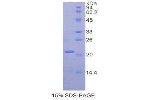 SDS-PAGE (SDS) image for Matrix Metallopeptidase 13 (Collagenase 3) (MMP13) (AA 287-449) protein (His tag) (ABIN1878291) (MMP13 Protein (AA 287-449) (His tag))