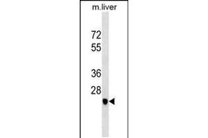 Western blot analysis in mouse liver tissue lysates (35ug/lane). (SGCD Antikörper  (C-Term))