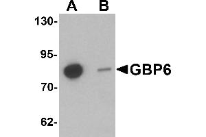 Western blot analysis of GBP6 in Hela cell lysate with GBP6 antibody at 0.