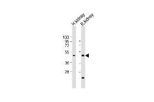 All lanes : Anti-KCNK12 Antibody (C-term) at 1:2000 dilution Lane 1: human kidney lysate Lane 2: rat kidney lysate Lysates/proteins at 20 μg per lane. (KCNK12 Antikörper  (C-Term))