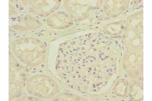 Immunohistochemistry (IHC) image for anti-Dynactin 6 (DCTN6) (AA 1-190) antibody (ABIN7150823)