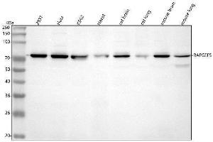 Western blot analysis of RAPGEF5 using anti-RAPGEF5 antibody (ABIN7600218).