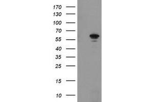 Western Blotting (WB) image for anti-Formiminotransferase Cyclodeaminase (FTCD) antibody (ABIN1496379) (FTCD Antikörper)