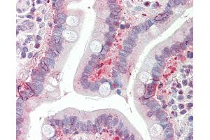 Anti-SLC25A19 antibody IHC staining of human small intestine.