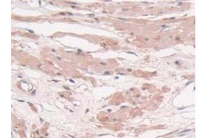 IHC-P analysis of Human Prostate Gland Tissue, with DAB staining. (Transgelin Antikörper  (AA 1-201))