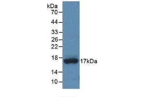 Detection of Recombinant ADAMTS4, Human using Monoclonal Antibody to A Disintegrin And Metalloproteinase With Thrombospondin 4 (ADAMTS4)