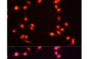 Immunofluorescence analysis of U-251MG cells using S100B Polyclonal Antibody at dilution of 1:100 (20x lens). (S100B Antikörper)