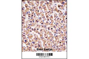 HYAL1 Antibody immunohistochemistry analysis in formalin fixed and paraffin embedded human liver tissue followed by peroxidase conjugation of the secondary antibody and DAB staining. (HYAL1 Antikörper  (C-Term))