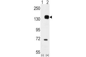 Western Blotting (WB) image for anti-TEK Tyrosine Kinase, Endothelial (TEK) antibody (ABIN3003424)