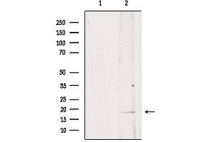 Western blot analysis of extracts from mouse brain, using ISG15 Antibody. (ISG15 Antikörper  (C-Term))
