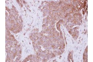 Immunohistochemistry (IHC) image for anti-Signal Transducing Adaptor Molecule (SH3 Domain and ITAM Motif) 1 (STAM) (Center) antibody (ABIN2856220)