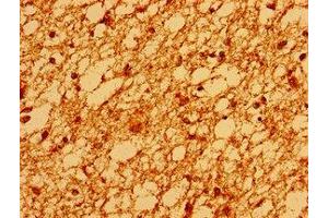 Immunohistochemistry of paraffin-embedded human brain tissue using ABIN7171099 at dilution of 1:100 (SV2A Antikörper  (AA 36-149))