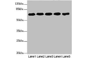 Western blot All lanes: KPNA6 antibody at 4. (KPNA6 Antikörper  (AA 277-536))