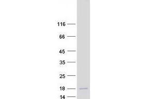 Validation with Western Blot (PDZK1 Interacting Protein 1 (PDZK1IP1) protein (Myc-DYKDDDDK Tag))