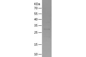 Western Blotting (WB) image for TBC1 Domain Family, Member 22A (TBC1D22A) (AA 2-280) protein (His tag) (ABIN7283321) (TBC1D22A Protein (AA 2-280) (His tag))