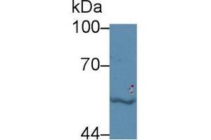 Western Blot; Sample: Human Jurkat cell lysate; Primary Ab: 5µg/ml Rabbit Anti-Bovine LBP Antibody Second Ab: 0. (LBP Antikörper  (AA 224-468))