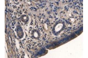 IHC-P analysis of Mouse Uterus Tissue, with DAB staining. (TMEM27 Antikörper  (Leu222))