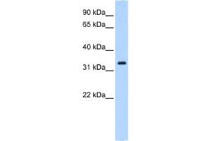 WB Suggested Anti-NCF4 Antibody Titration:  0. (NCF4 Antikörper  (N-Term))